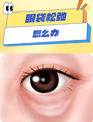 去眼袋手术