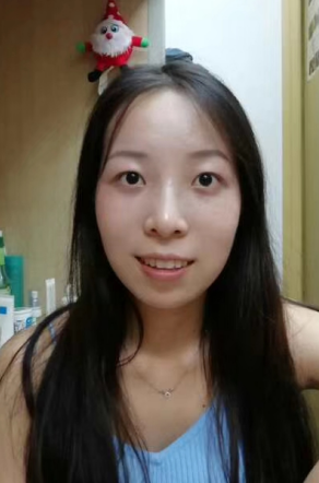 去眼袋手术