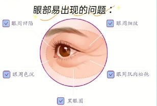 去眼袋手术