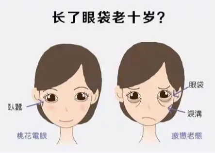 去眼袋手术