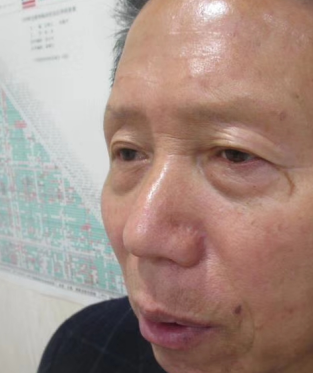 去眼袋手术