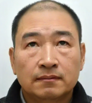 去眼袋手术