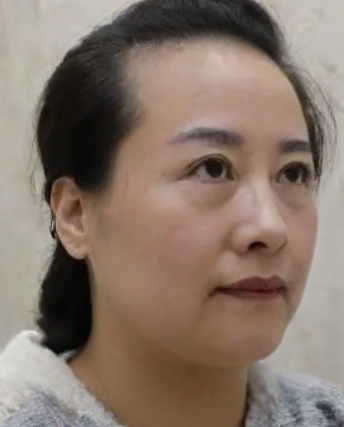 去眼袋手术