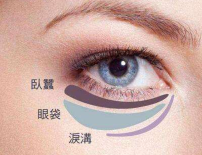 去眼袋手术