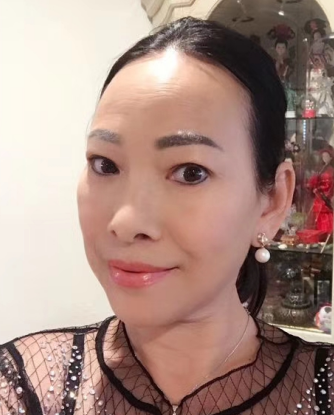去眼袋手术