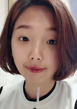 去眼袋手术