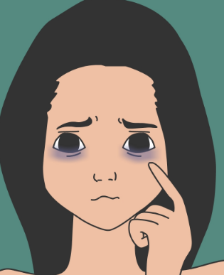 去眼袋手术