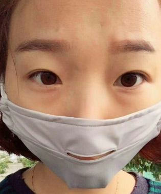 去眼袋手术