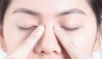 去眼袋手术