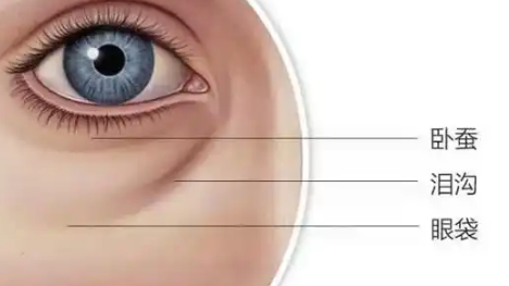 去眼袋手术