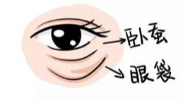 去眼袋手术