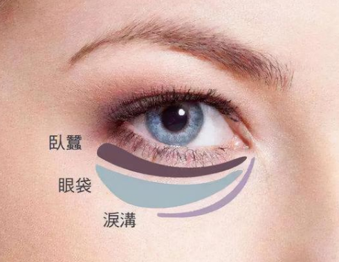 去眼袋手术