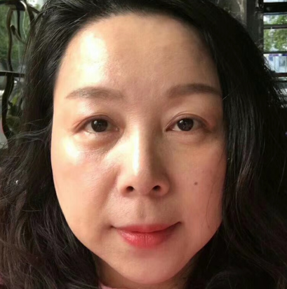 去眼袋手术