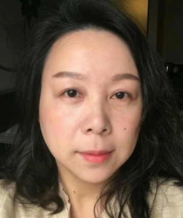 去眼袋手术