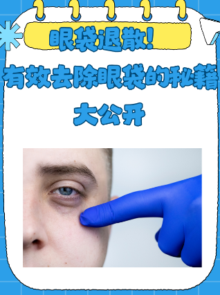 去眼袋手术