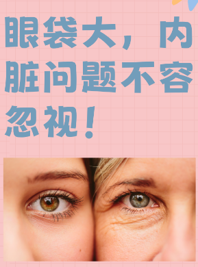 去眼袋手术