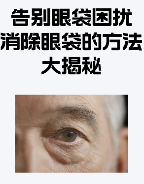 去眼袋手术