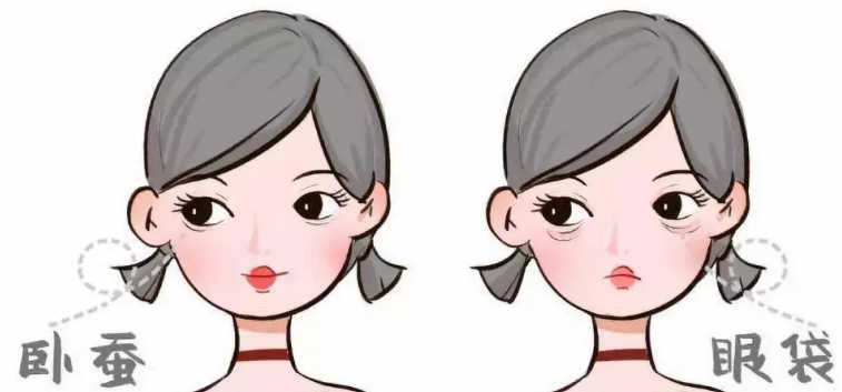 去眼袋手术