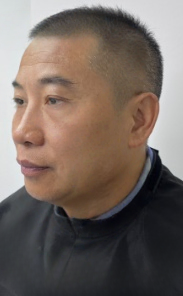 去眼袋手术