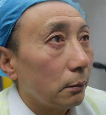 去眼袋手术