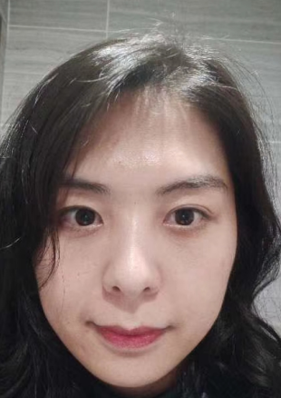 去眼袋手术