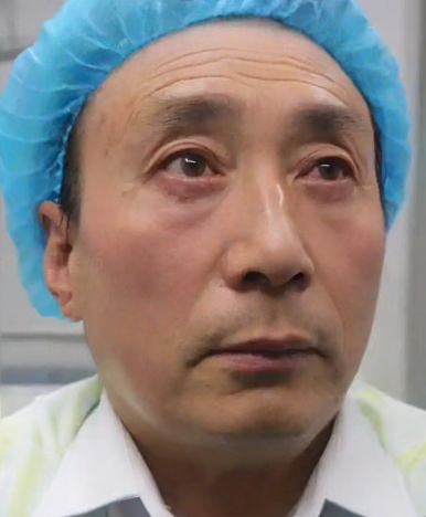 去眼袋手术