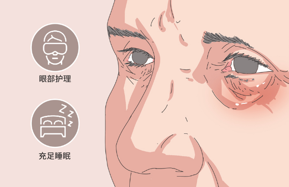 去眼袋手术