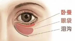 去眼袋手术