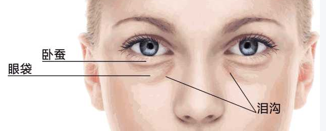 去眼袋手术