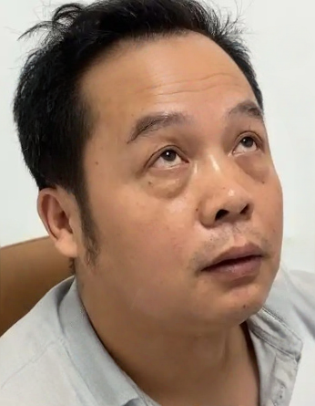 去眼袋手术