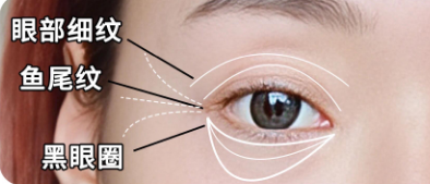 眼袋