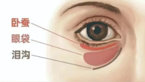 眼袋