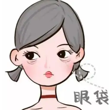 去眼袋手术