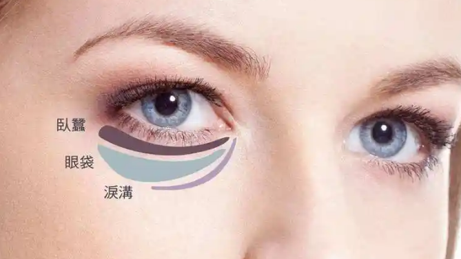 去眼袋手术