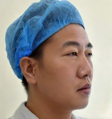 去眼袋手术