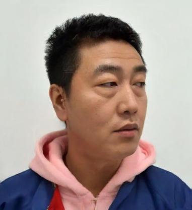 去眼袋手术
