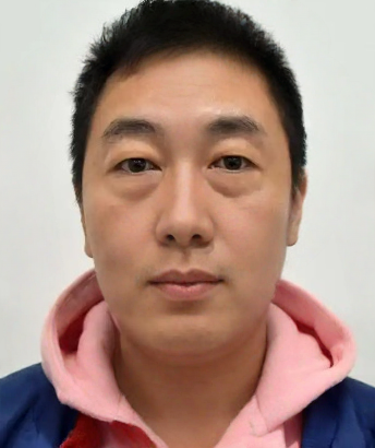 去眼袋手术