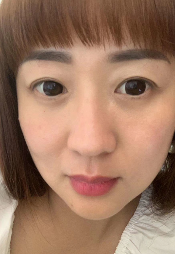 去眼袋手术