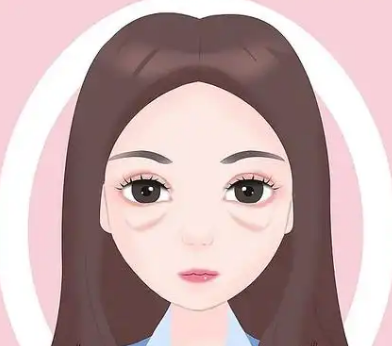 去眼袋手术