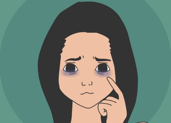 去眼袋手术