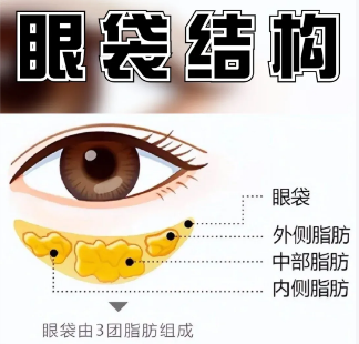 眼袋