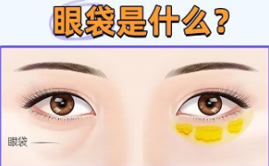 眼袋