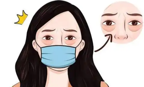 眼袋