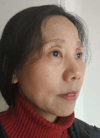 去眼袋手术