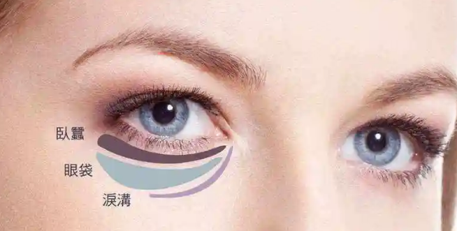 去眼袋手术