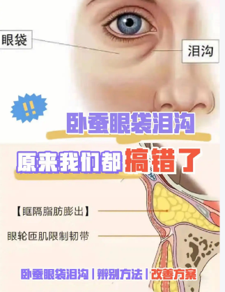 眼袋