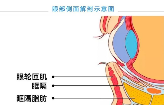 眼袋