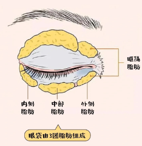 眼袋