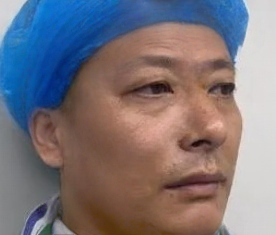眼袋