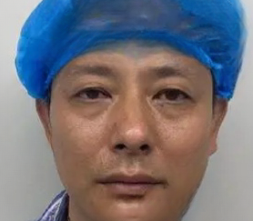 眼袋